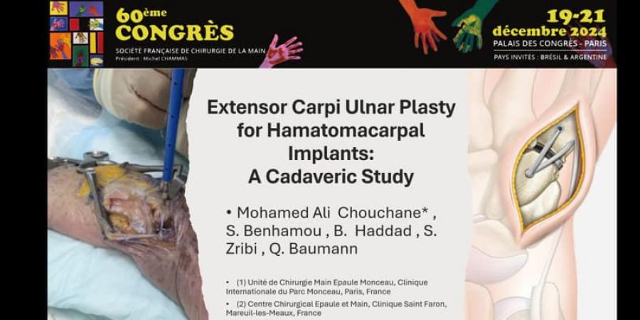 Tunisian Doctor Presents Innovative Surgical Technique at Global Conference in Paris - الخبر اليمني